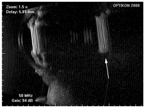 Figure 14