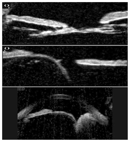 Figure 12