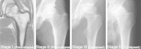 Fig.2