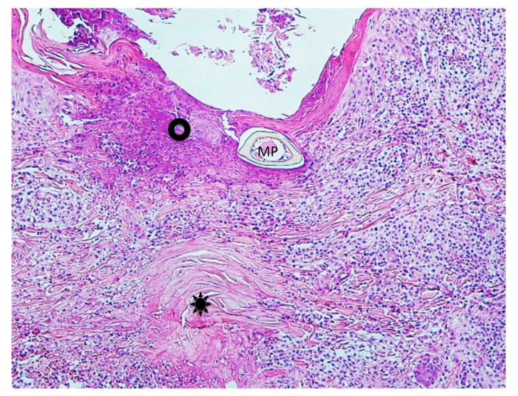 Fig. 13.