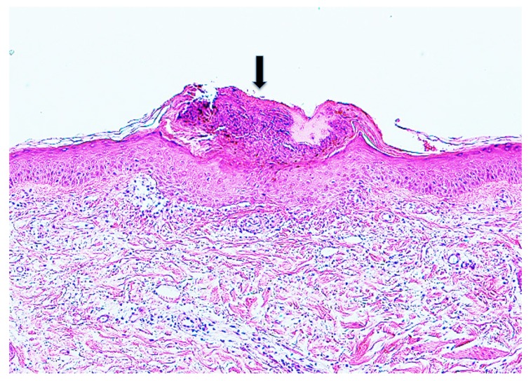 Fig. 11.