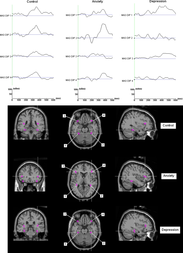 Fig. 4