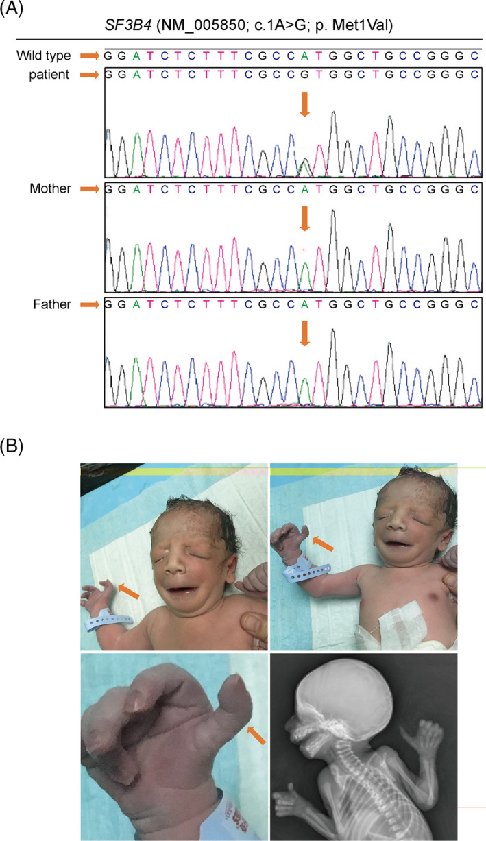 FIGURE 3