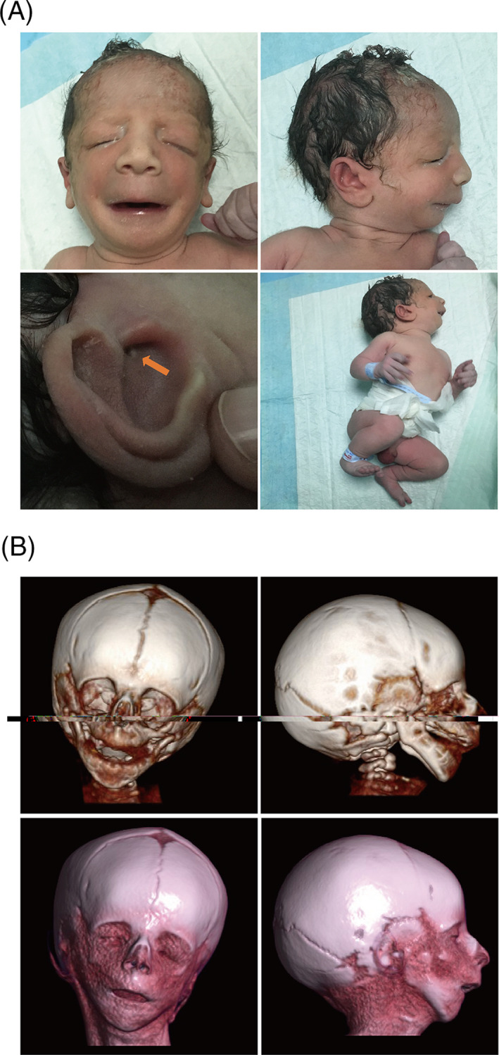 FIGURE 1