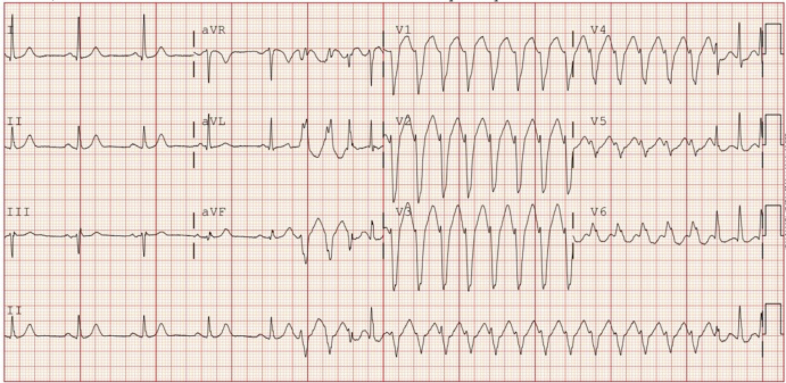 Figure 1