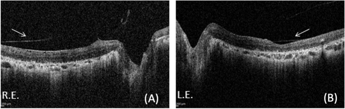 Fig. 3