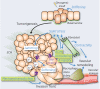 Figure 1. Changes in mechanical and biophysical properties of epithelial cells (blue font) start at the pre-cancerous stage and dynamically take place throughout from tumorigenesis to metastasis. Several components of the tumor microenvironment such as the fibroblasts, macrophages, and the extracellular matrix (ECM) contribute to these changes.