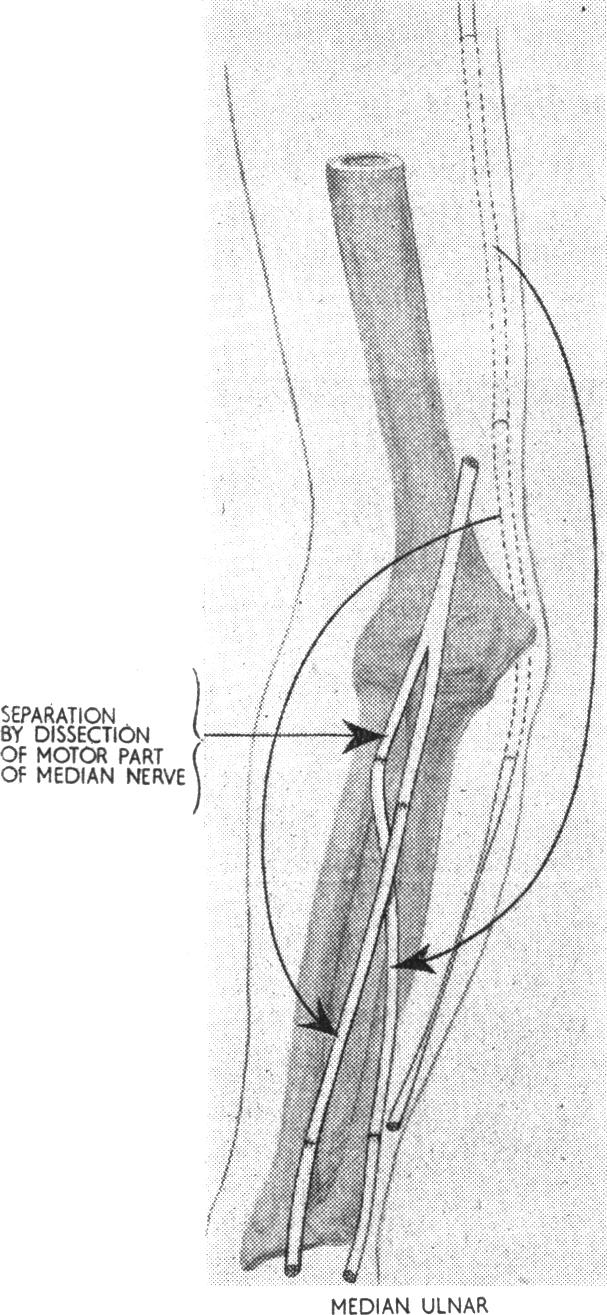 Fig. V