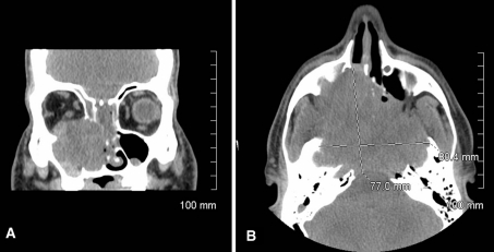 Fig. 1