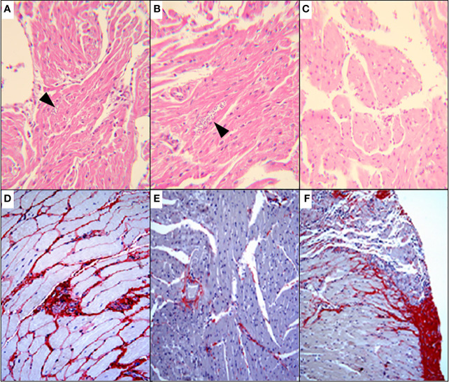 Figure 13