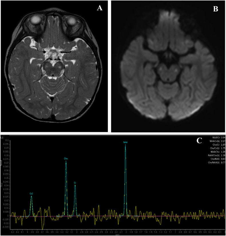 Fig. 1