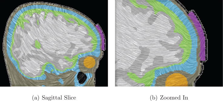 Figure 14