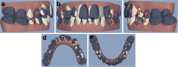 Figure 14