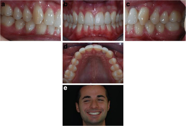 Figure 16