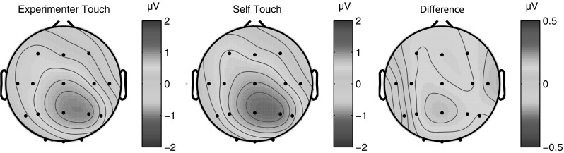 Fig. 11