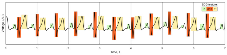 Figure 16