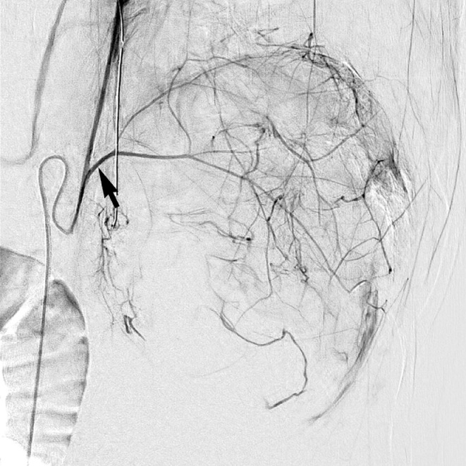 Fig. 2 –