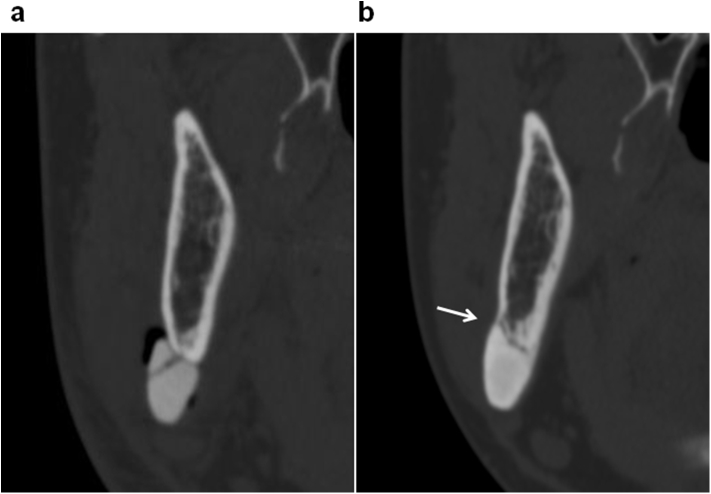 Fig. 7