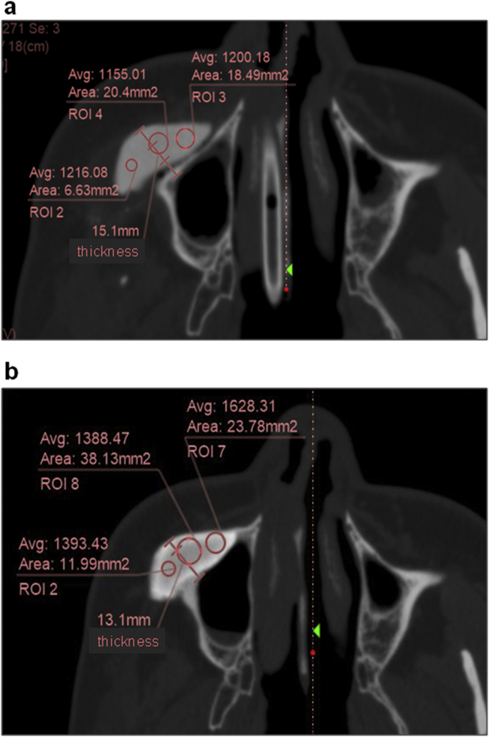 Fig. 1