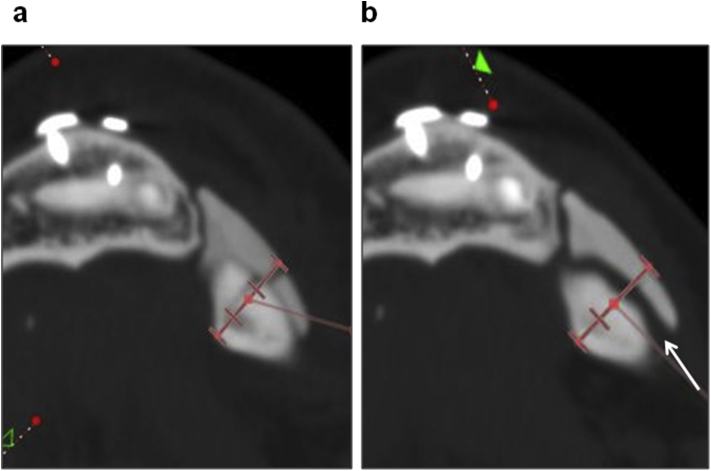 Fig. 3