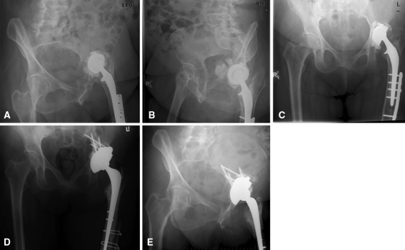 Fig. 2A–E