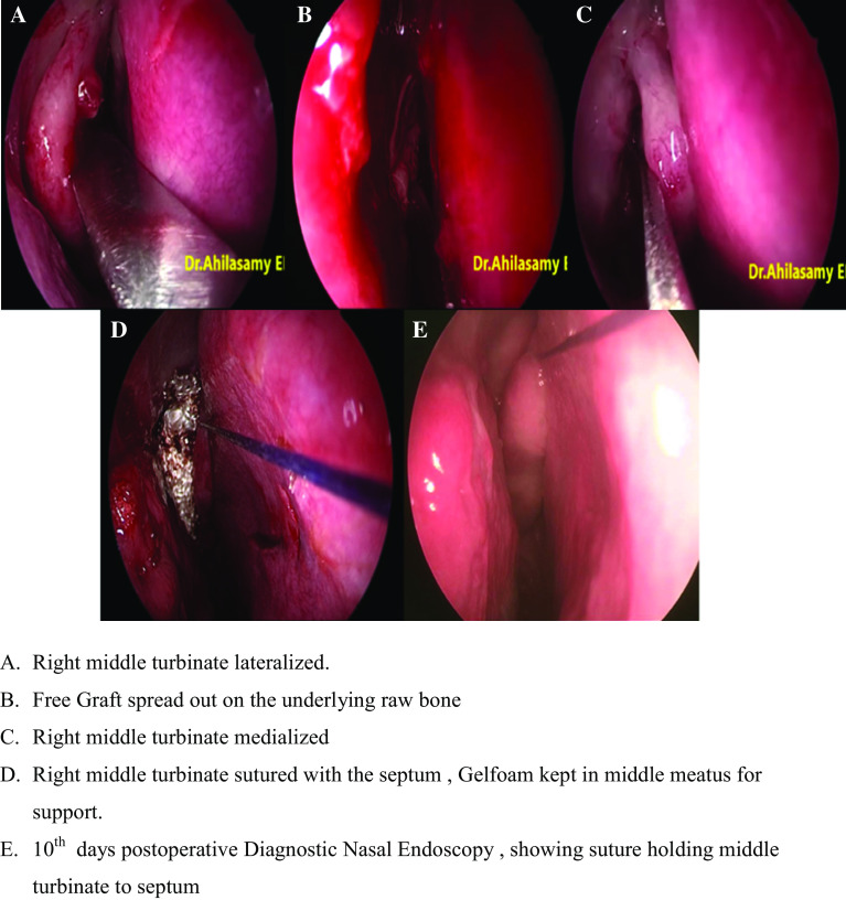 Fig. 2