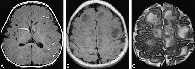 fig 6.