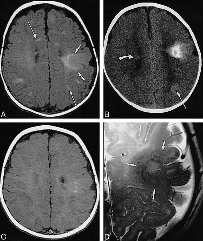 fig 3.