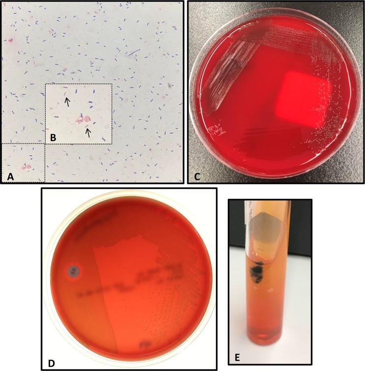 FIG 1