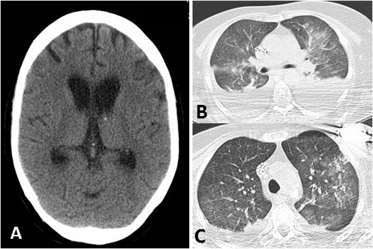 Fig. 1