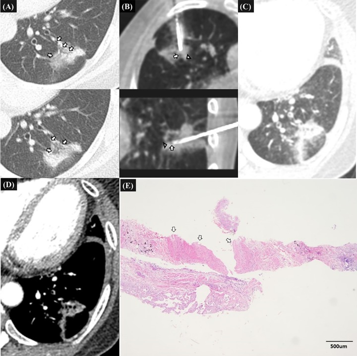 Fig 3