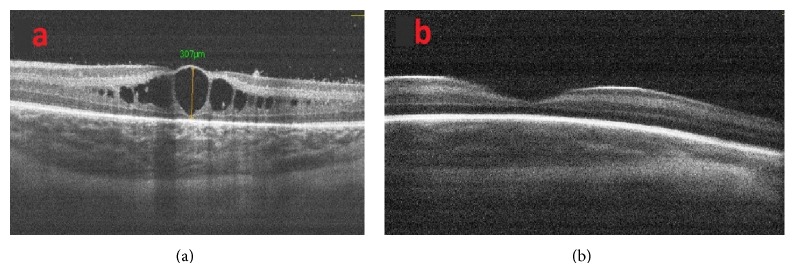 Figure 5