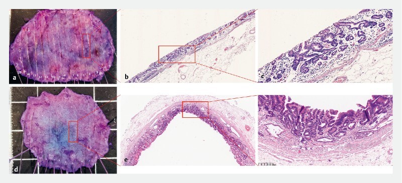 Fig. 4