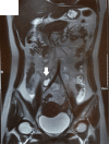 Fig 2 –