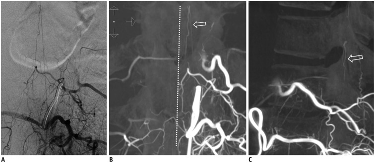 Fig. 11