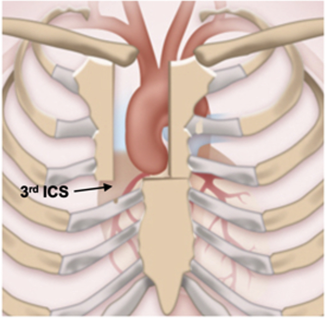 Figure 2