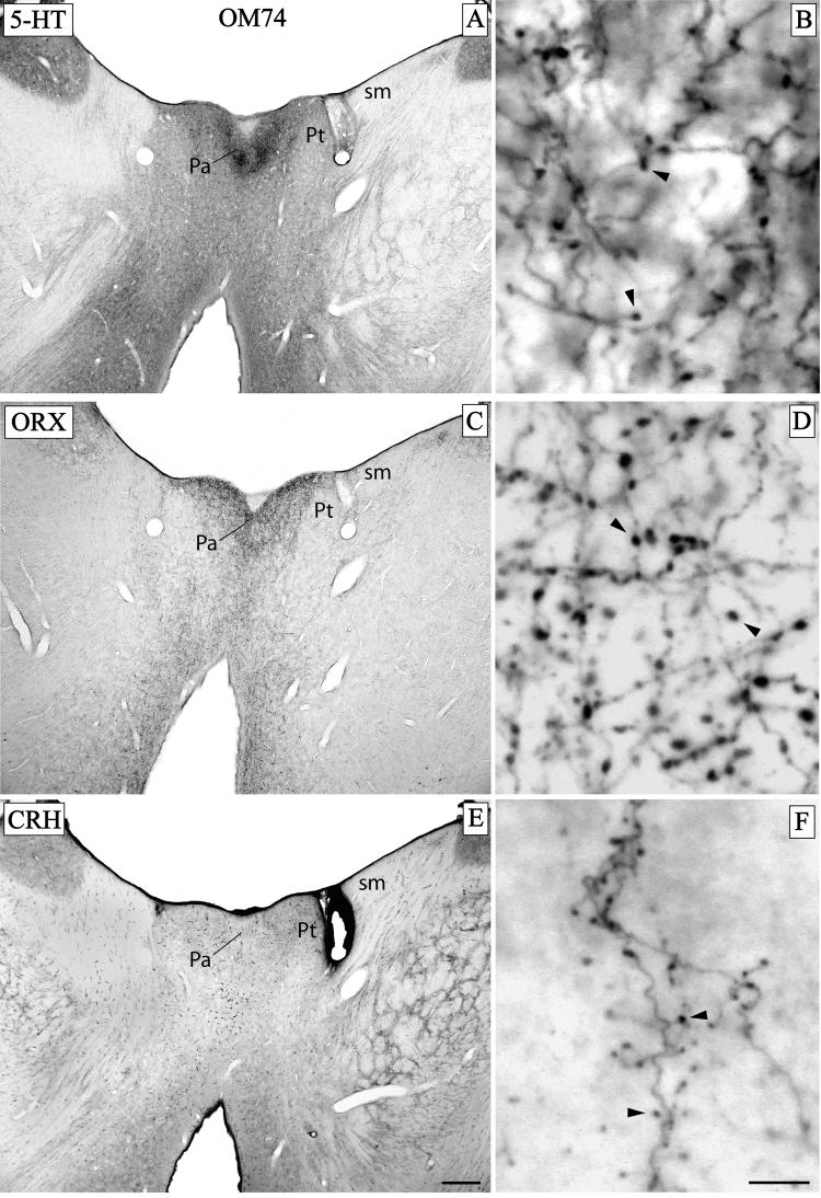 Fig. 11