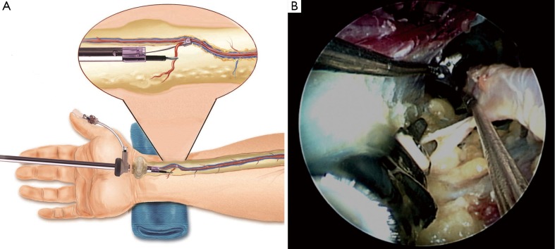 Figure 13