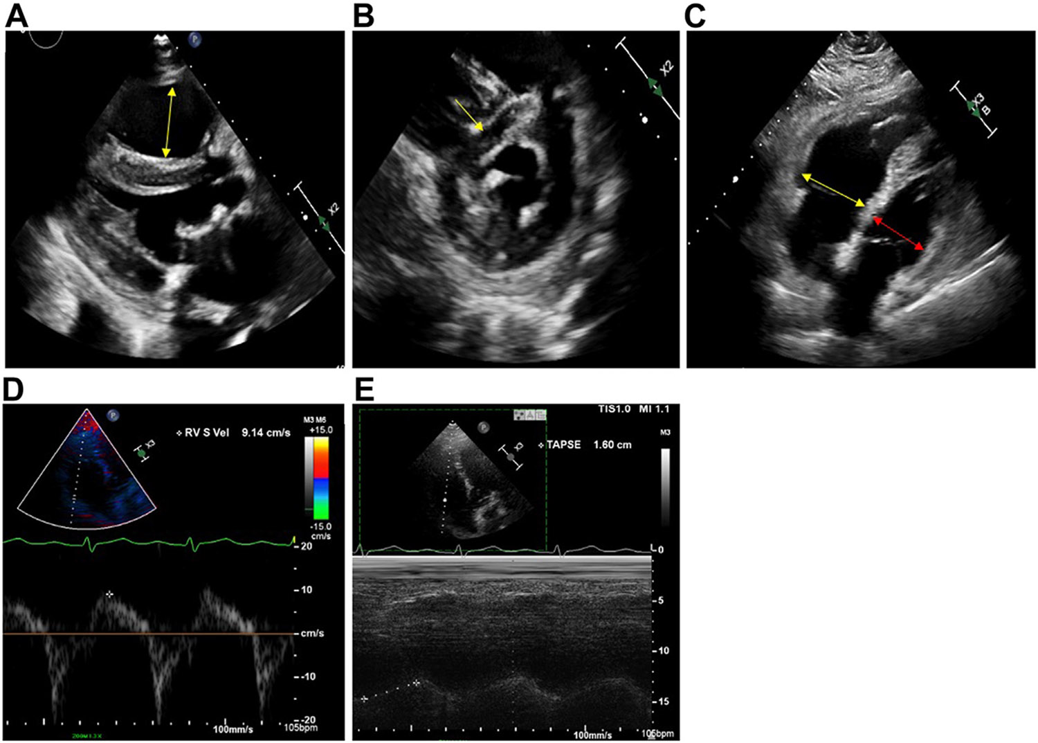 FIGURE 3