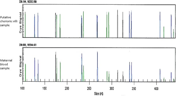 Fig. 2