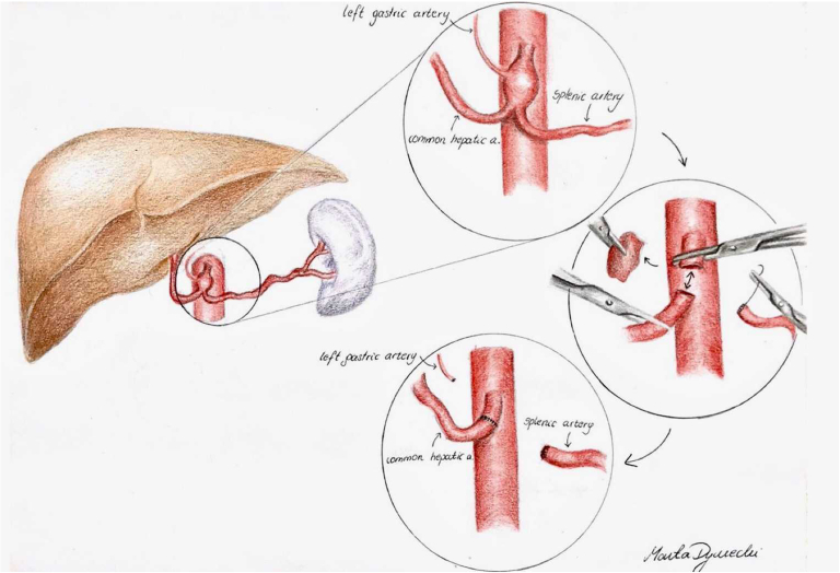 Fig 2