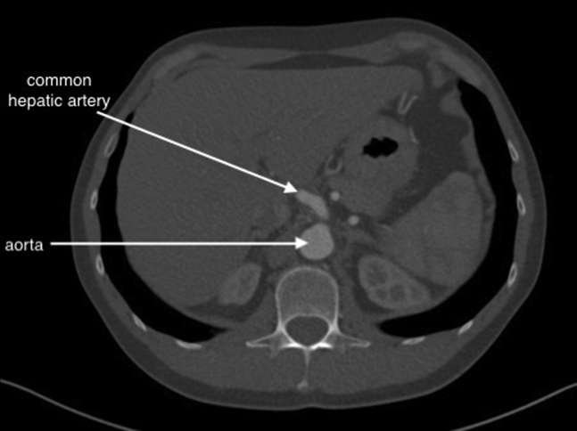 Fig 3