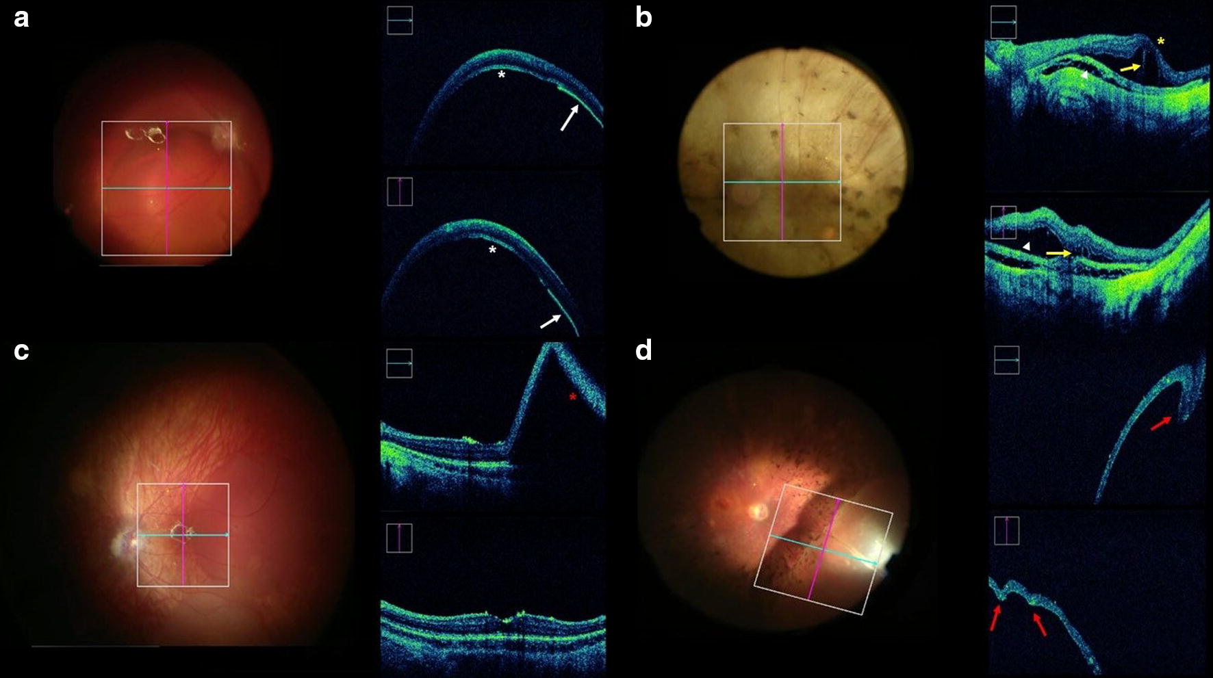 Fig. 4