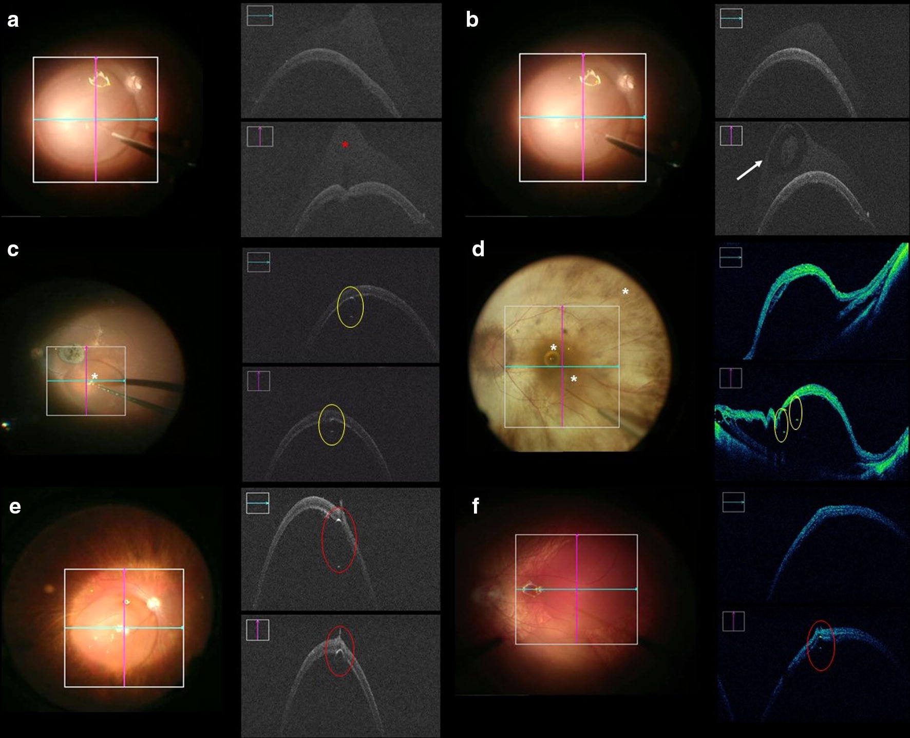 Fig. 3