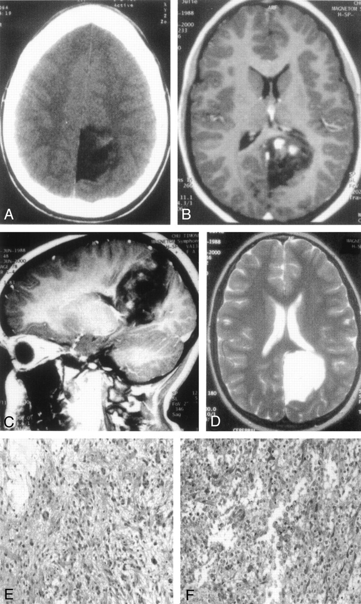 Fig 2.