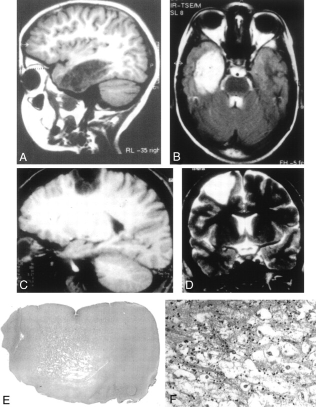 Fig 1.