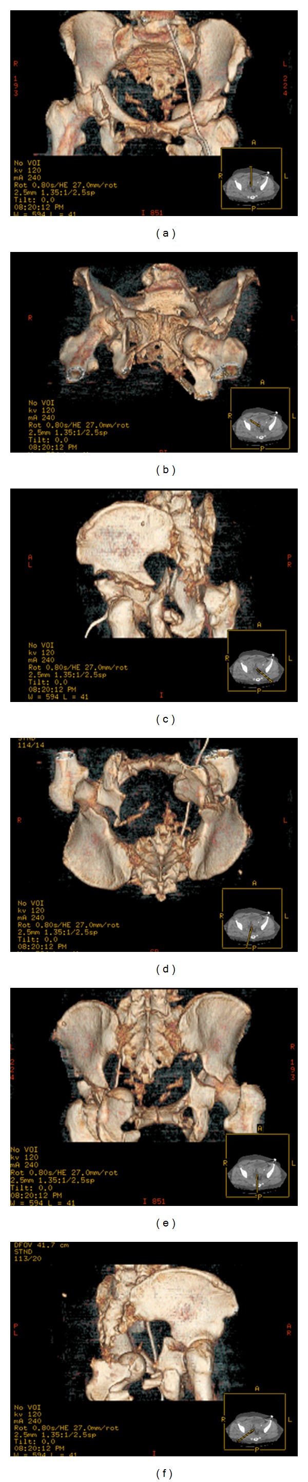 Figure 2