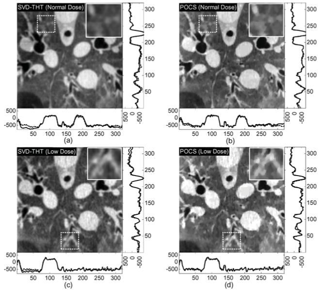 Fig. 21