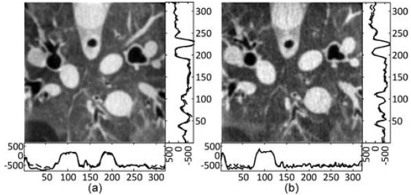 Fig. 16