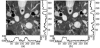 Fig. 16